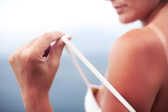 How Do I Prevent Skin Cancer?