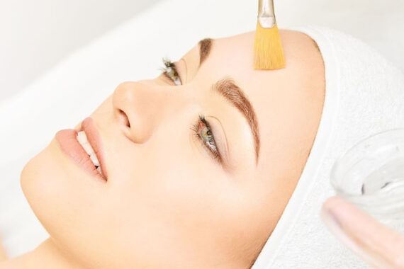 Is a Chemical Peel Safe for Sensitive Skin?