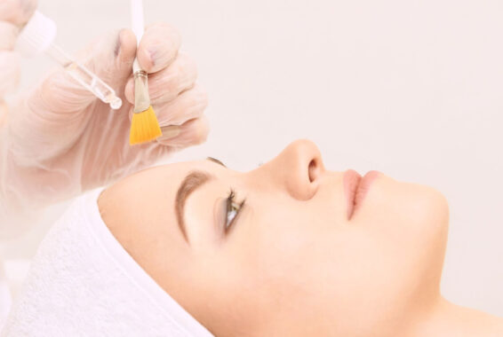 What Are the Potential Side Effects of Chemical Peels?