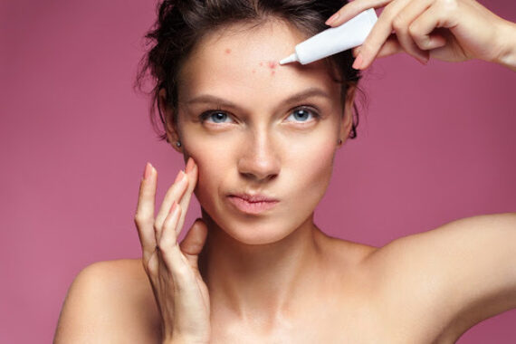 Over-the-Counter Acne Treatments Not Working? Try These Cosmetic Dermatology Services