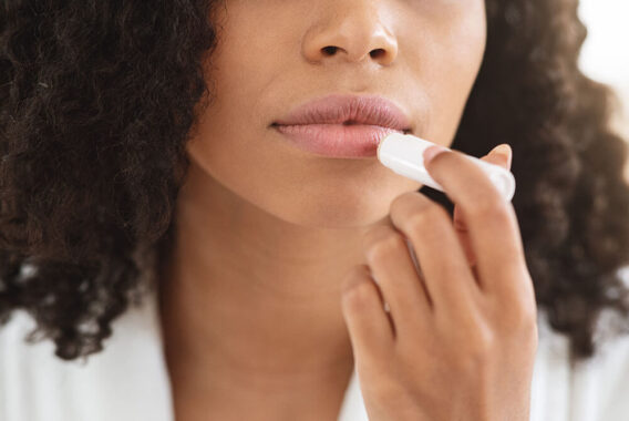 4 Tips for Preventing Chapped Lips