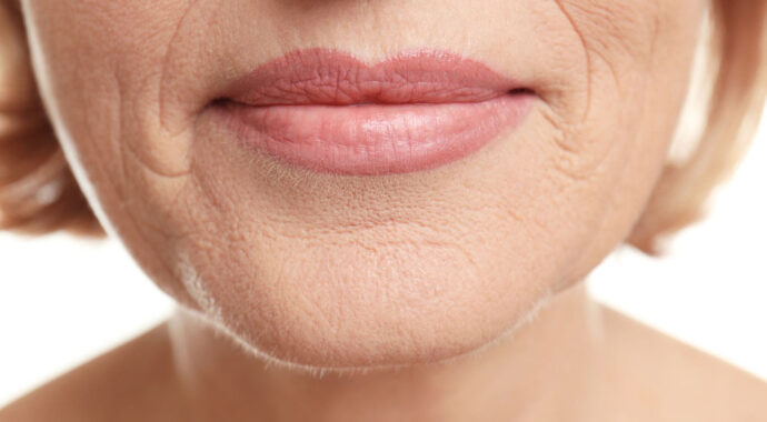 Is Botox Right for Me? Exploring Wrinkle Treatments