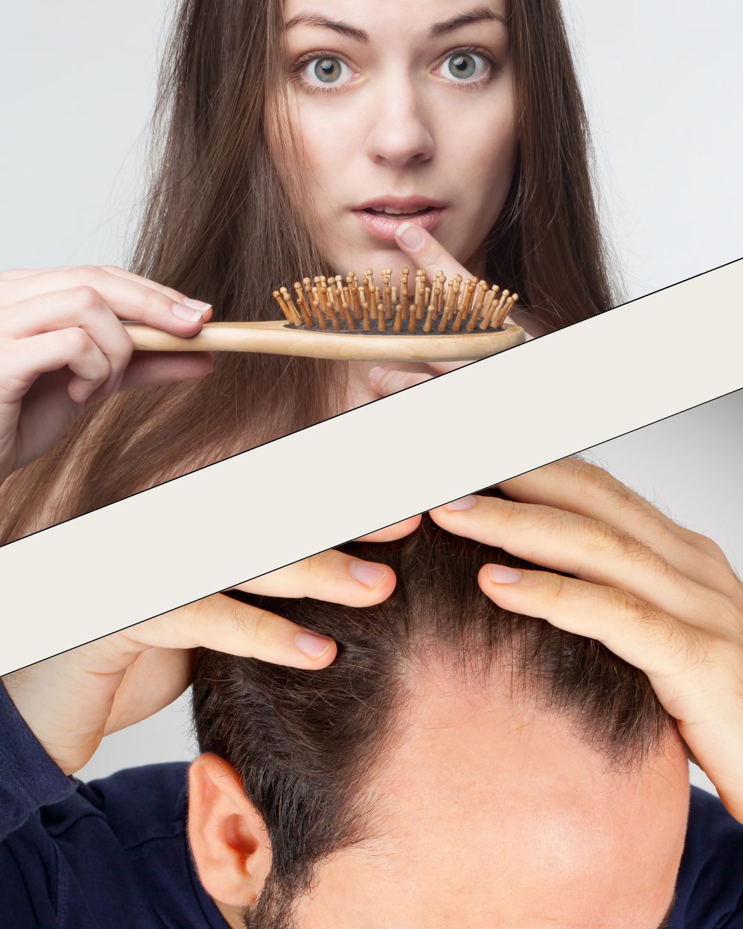 Male vs. Female Pattern Hair Loss: Causes & Treatment Guide